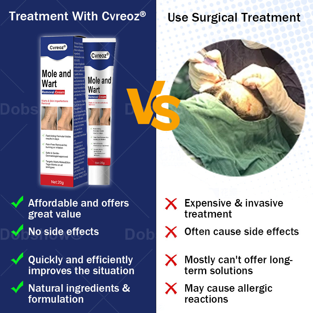 🎁𝘾𝙝𝙧𝙞𝙨𝙩𝙢𝙖𝙨 𝙎𝙖𝙡𝙚 | Cvreoz® Mole and Wart Removal Cream