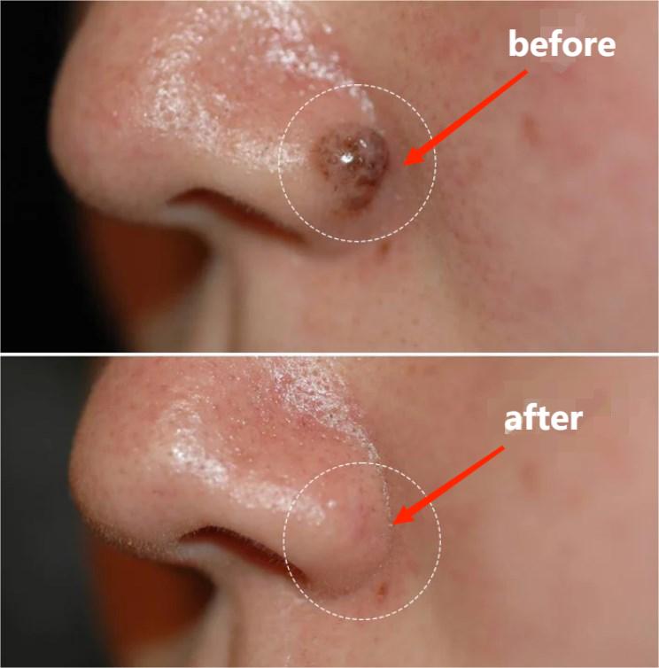 Dobshow™ AraneaCare Skin Blemish Remover - Pet Friendly