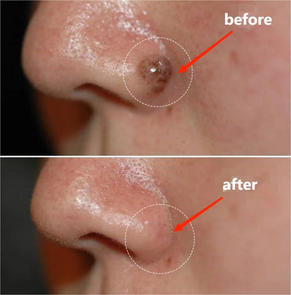 Dobshow™ AraneaCare Skin Blemish Remover - Pet Friendly