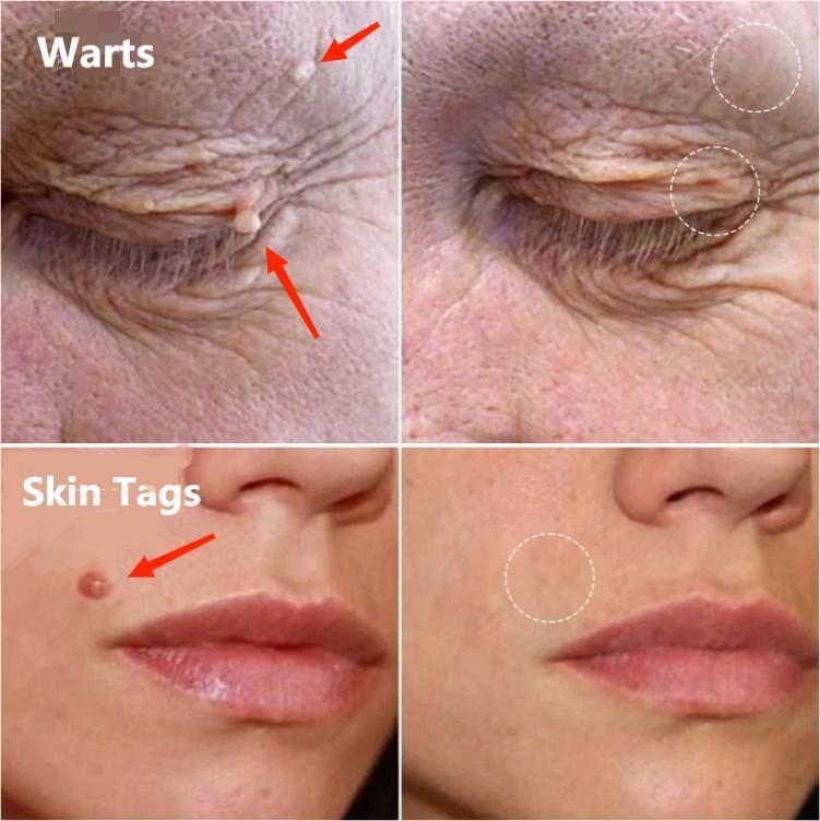 Dobshow™ AraneaCare Skin Blemish Remover - Pet Friendly