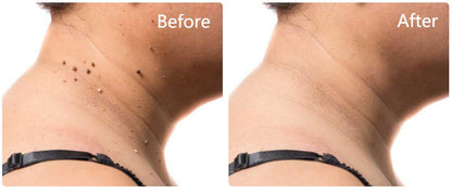 Dobshow™ AraneaCare Skin Blemish Remover - Pet Friendly
