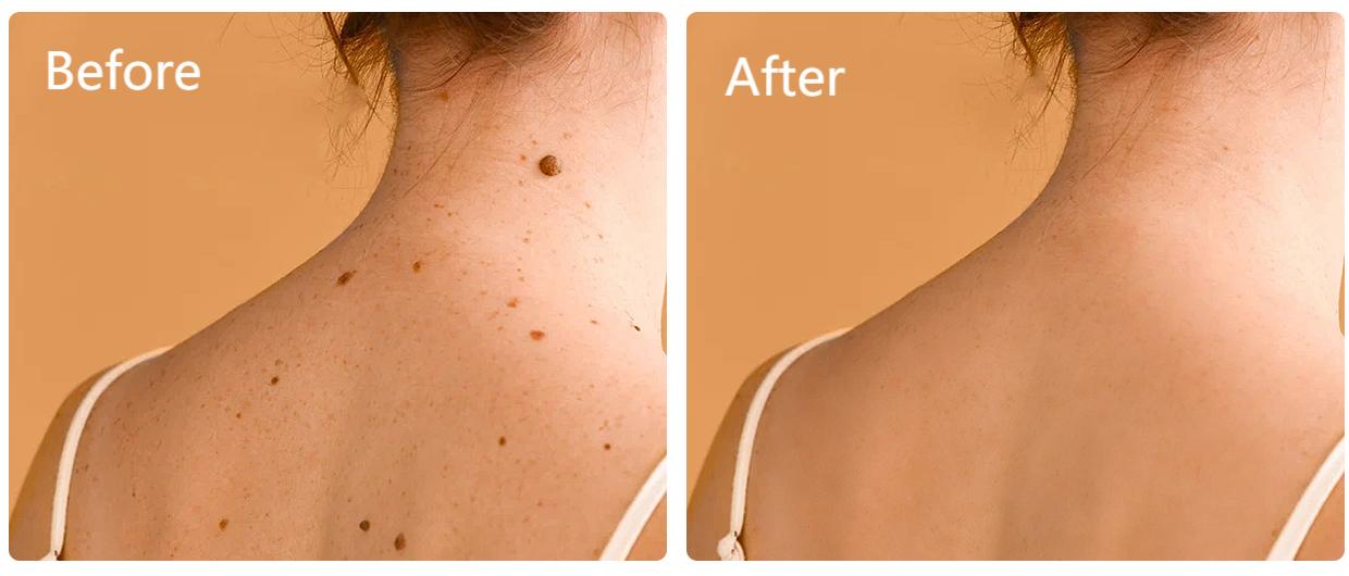Dobshow™ AraneaCare Skin Blemish Remover - Pet Friendly