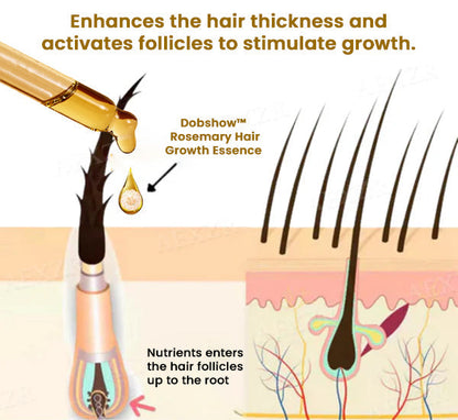 Dobshow® Rosemary Hair Growth Essence