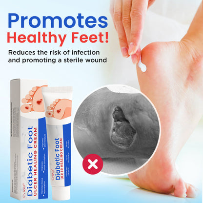 `Cvreoz® Diabetic Foot Ulcer Healing Cream