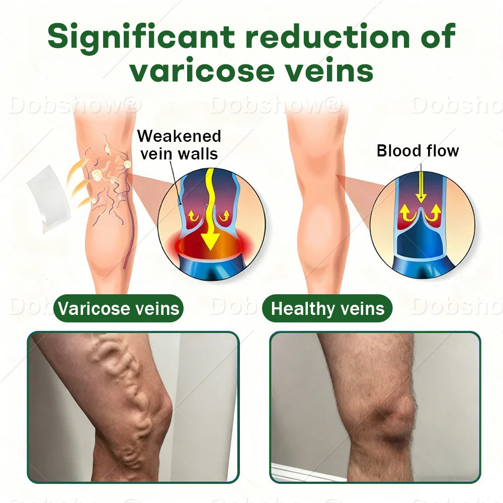 🎄𝘾𝙝𝙧𝙞𝙨𝙩𝙢𝙖𝙨 𝙎𝙖𝙡𝙚| Croaie® VeinLock Microneedle Patch