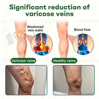 🎄𝘾𝙝𝙧𝙞𝙨𝙩𝙢𝙖𝙨 𝙎𝙖𝙡𝙚| Croaie® VeinLock Microneedle Patch