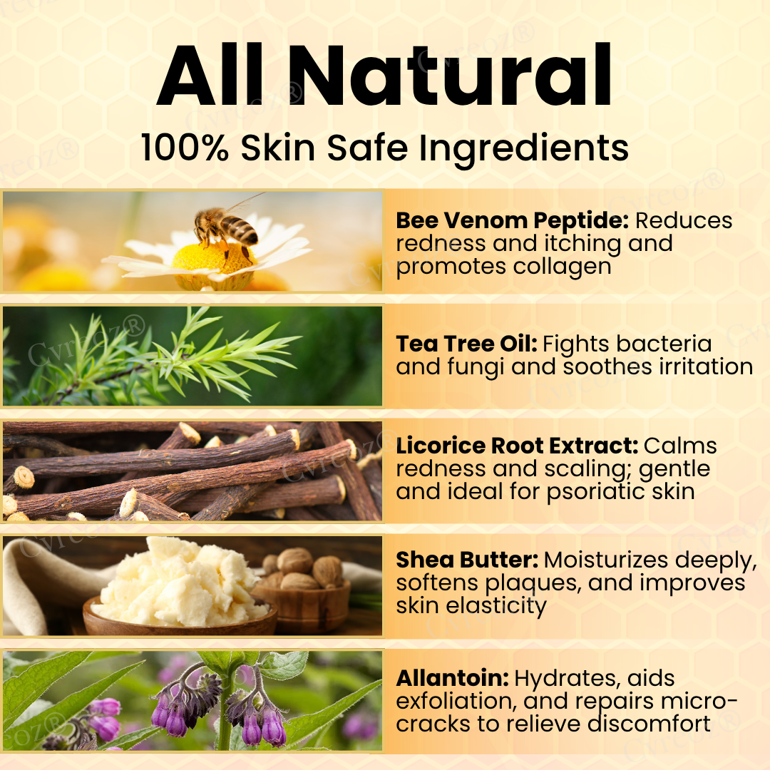 Cvreoz® Bee Venom Psoriasis Care Cream