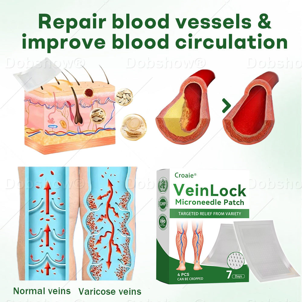 🎄𝘾𝙝𝙧𝙞𝙨𝙩𝙢𝙖𝙨 𝙎𝙖𝙡𝙚| Croaie® VeinLock Microneedle Patch