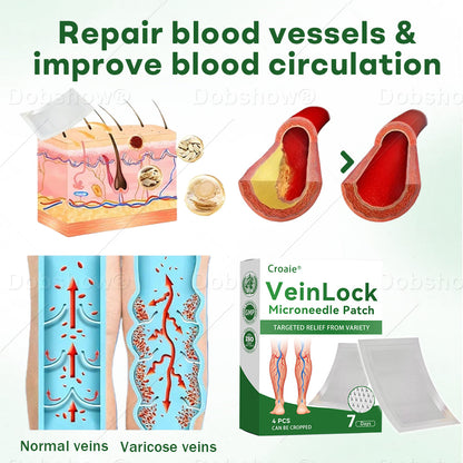 🎄𝘾𝙝𝙧𝙞𝙨𝙩𝙢𝙖𝙨 𝙎𝙖𝙡𝙚| Croaie® VeinLock Microneedle Patch