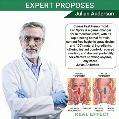 🎁𝘾𝙝𝙧𝙞𝙨𝙩𝙢𝙖𝙨 𝙎𝙖𝙡𝙚 | Cvreoz® Fast Hemorrhoid PRO Spray