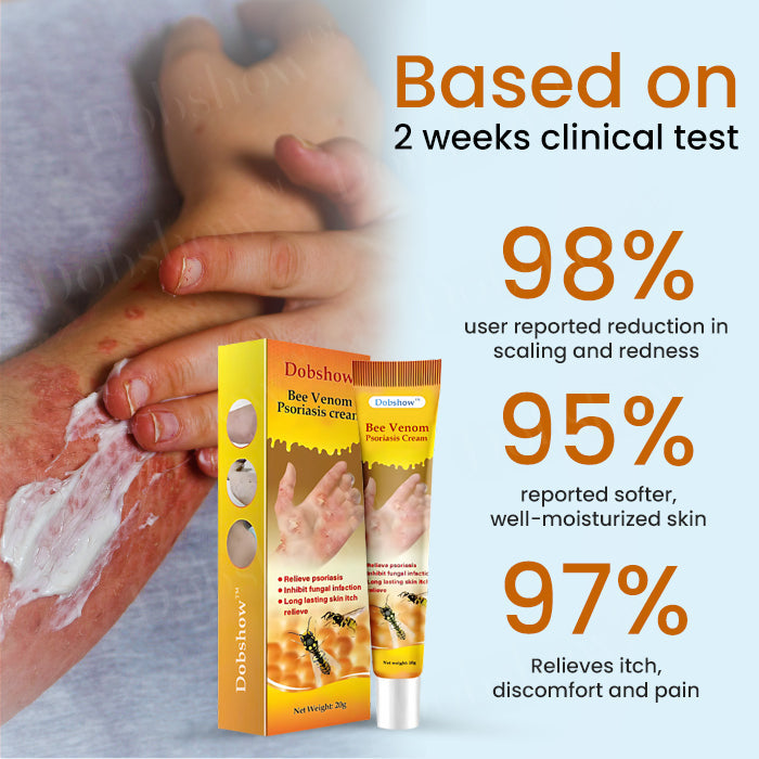 Dobshow™ Bee Venom Psoriasis Cream