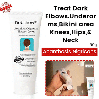 Dobshow™ Acanthosis Nigricans Hyperpigmentation Therapy Cream 🌟