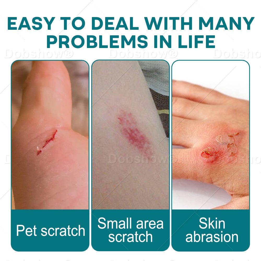 🎄𝘾𝙝𝙧𝙞𝙨𝙩𝙢𝙖𝙨 𝙎𝙖𝙡𝙚 | Croaie® SKINSHIELD QUICKDRYING LIQUID BANDAGE