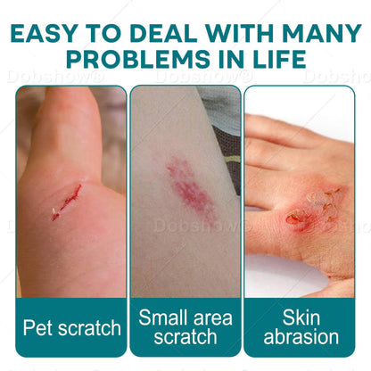 🎄𝘾𝙝𝙧𝙞𝙨𝙩𝙢𝙖𝙨 𝙎𝙖𝙡𝙚 | Croaie® SKINSHIELD QUICKDRYING LIQUID BANDAGE