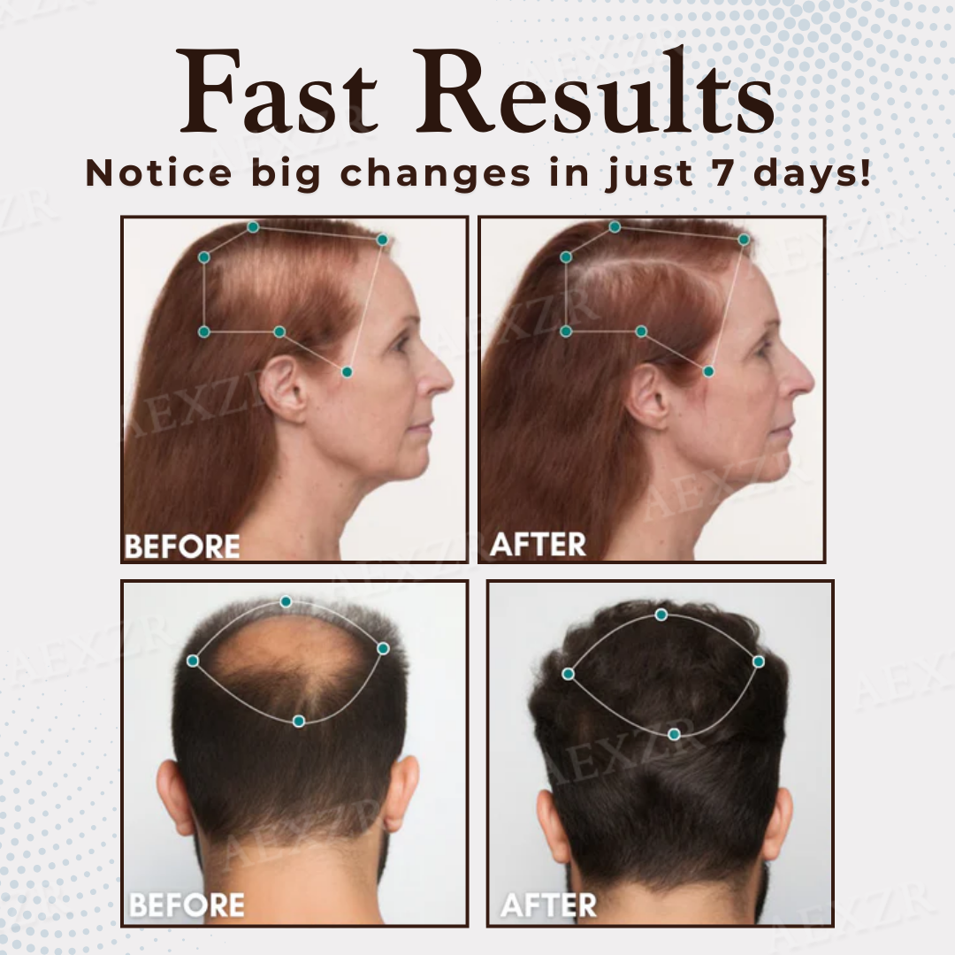 🔥𝙇𝙞𝙢𝙞𝙩𝙚𝙙-𝙏𝙞𝙢𝙚 𝙊𝙛𝙛𝙚𝙧 | Healrize® Hair Regrowth Capsules| Revive Follicles, Boost Hair Volume