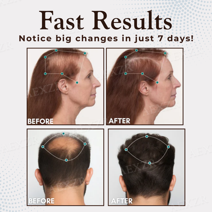 🔥𝙇𝙞𝙢𝙞𝙩𝙚𝙙-𝙏𝙞𝙢𝙚 𝙊𝙛𝙛𝙚𝙧 | Healrize® Hair Regrowth Capsules| Revive Follicles, Boost Hair Volume