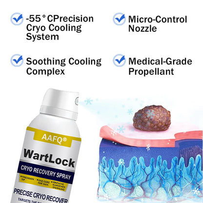 AAFQ®  WartLock Cryo Rcovery Spray