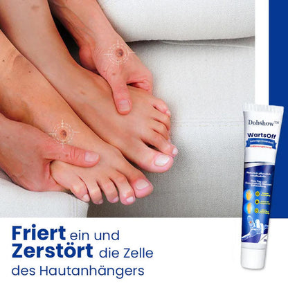 Dobshow™ WartsOff Rapid Creme zur sofortigen Entfernung von Hautunreinheiten