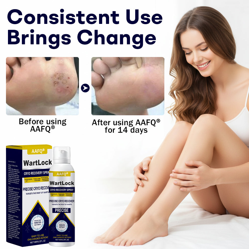 AAFQ®  WartLock Cryo Rcovery Spray