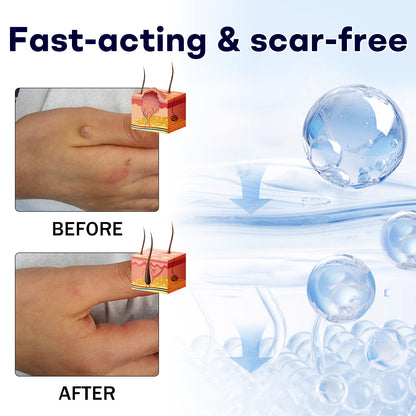 AAFQ®  WartLock Cryo Rcovery Spray