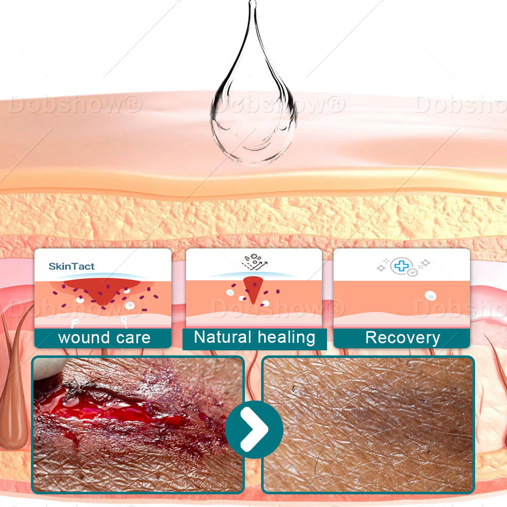 🎄𝘾𝙝𝙧𝙞𝙨𝙩𝙢𝙖𝙨 𝙎𝙖𝙡𝙚 | Croaie® SKINSHIELD QUICKDRYING LIQUID BANDAGE