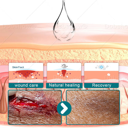 🎄𝘾𝙝𝙧𝙞𝙨𝙩𝙢𝙖𝙨 𝙎𝙖𝙡𝙚 | Croaie® SKINSHIELD QUICKDRYING LIQUID BANDAGE