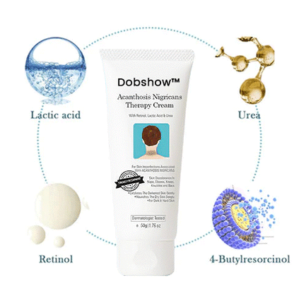 Dobshow™ Acanthosis Nigricans Hyperpigmentation Therapy Cream 🌟