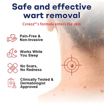 🎁𝘾𝙝𝙧𝙞𝙨𝙩𝙢𝙖𝙨 𝙎𝙖𝙡𝙚 | Cvreoz® Mole and Wart Removal Cream