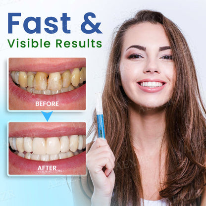 Dobshow™ Teeth Whitening Pen