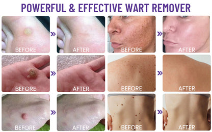 Dobshow™ AraneaCare Skin Blemish Remover - Pet Friendly