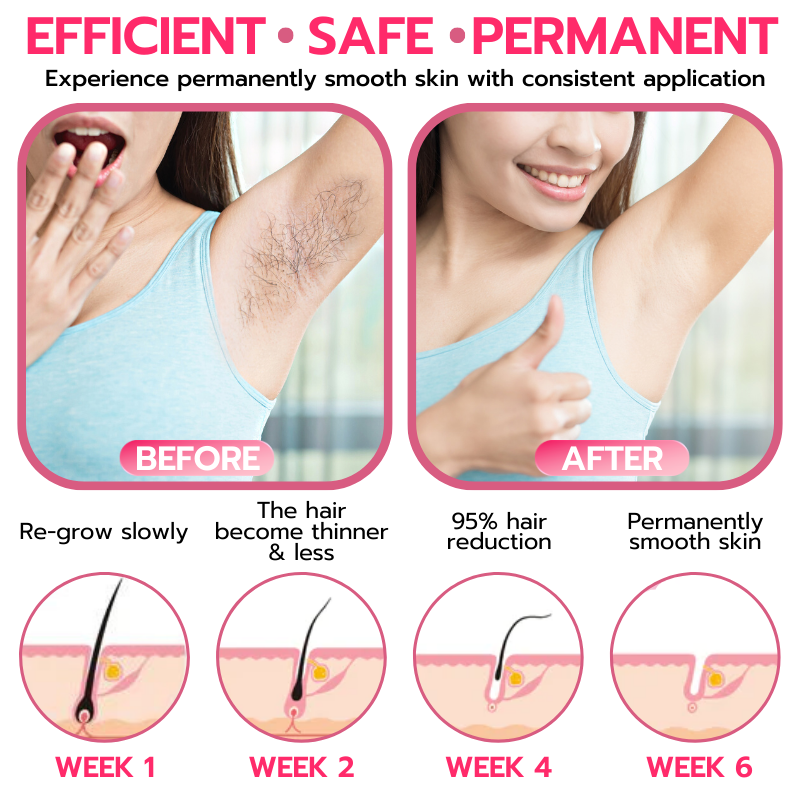 Softee™🐝 Beeswax Hair Removal Mousse