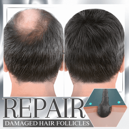Dobshow Anti-Shedding Hair Spray