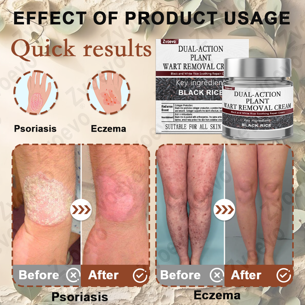 ✨ Zvoevo® Rice Bran Extract Cream 👩‍⚕️ FDA-Certified (For removing warts and skin growths, eliminating skin hyperplasia and keratin buildup, treating skin cancer, age spots, and hyperpigmentation)