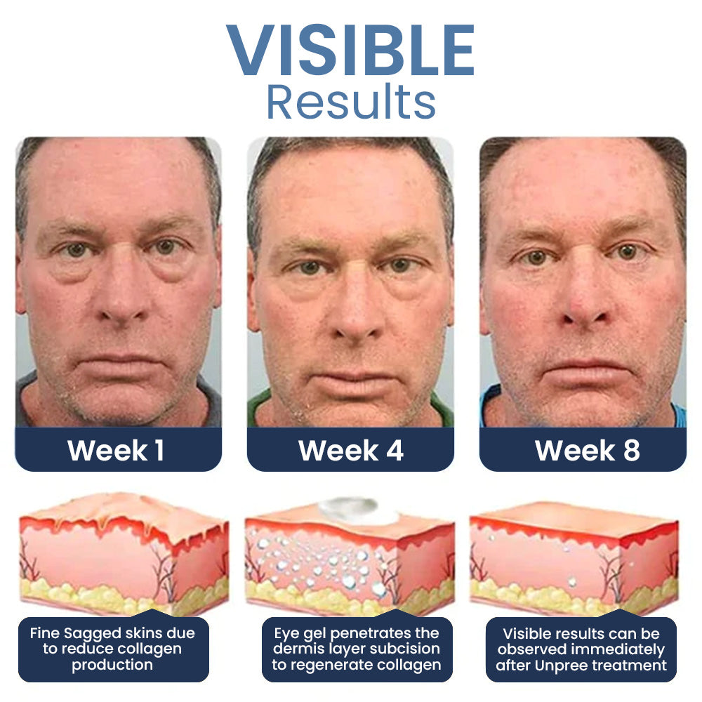 Early Father's Day Promotion 🔥 Dobshow™PEPTIDE Depuffing Eye Serum 🔥 LAST DAY SALE 80% OFF 🔥