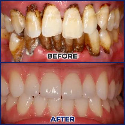 🎄𝘾𝙝𝙧𝙞𝙨𝙩𝙢𝙖𝙨 𝙎𝙖𝙡𝙚 | Croaie® ApiGuard BeeVenom Therapeutic Oral Drops & Rinse