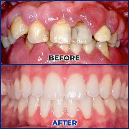 🎄𝘾𝙝𝙧𝙞𝙨𝙩𝙢𝙖𝙨 𝙎𝙖𝙡𝙚 | Croaie® ApiGuard BeeVenom Therapeutic Oral Drops & Rinse