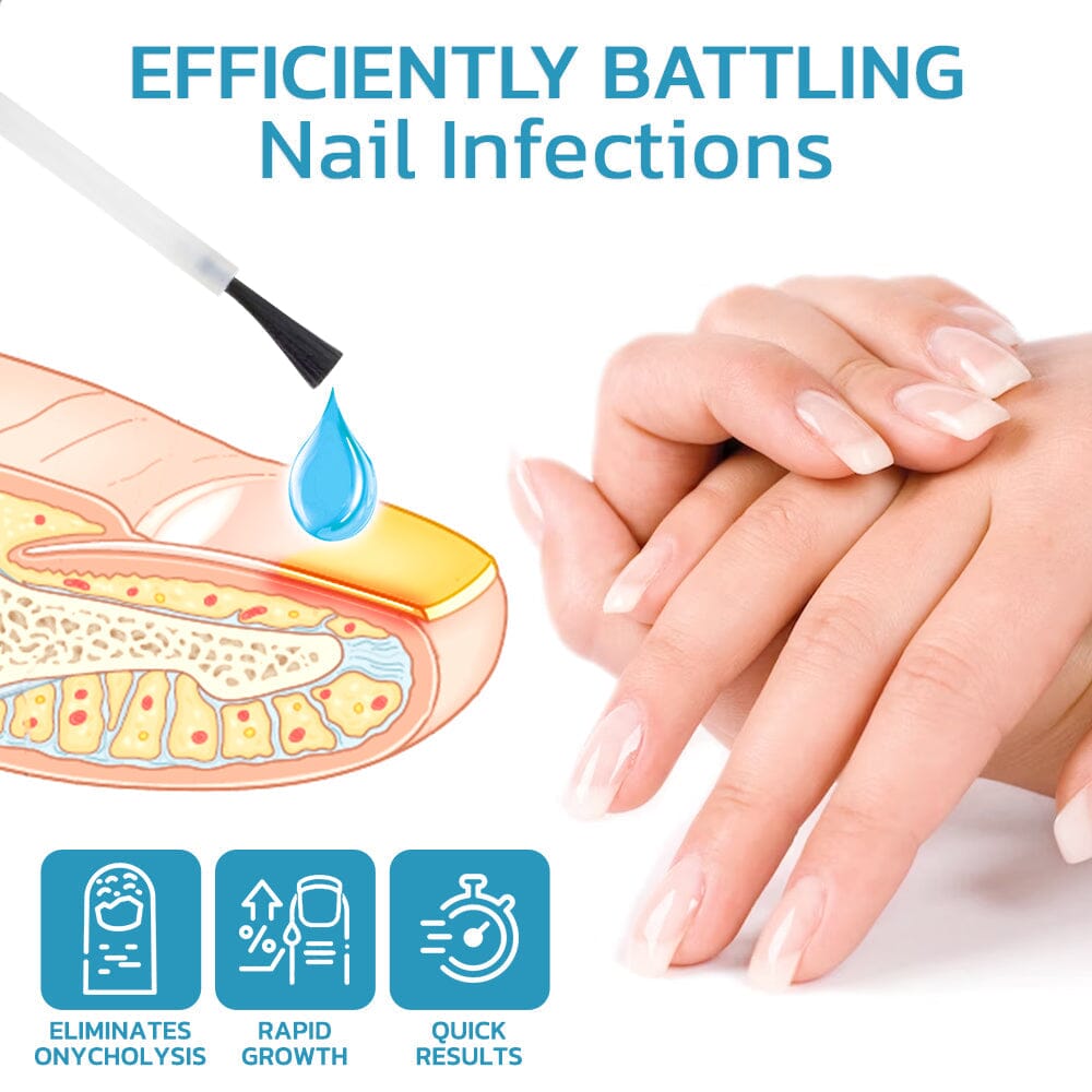 Nurbini™ OnycholysisHeal Nail Strengthening And Growth Conditioner