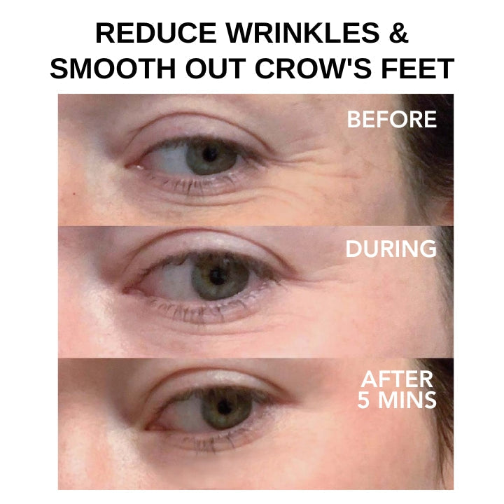 Dobshow™ Wetenschappelijk geformuleerde oogverzorgingsoplossingen: Clinical SkinCare's onmiddellijke oogversteviger