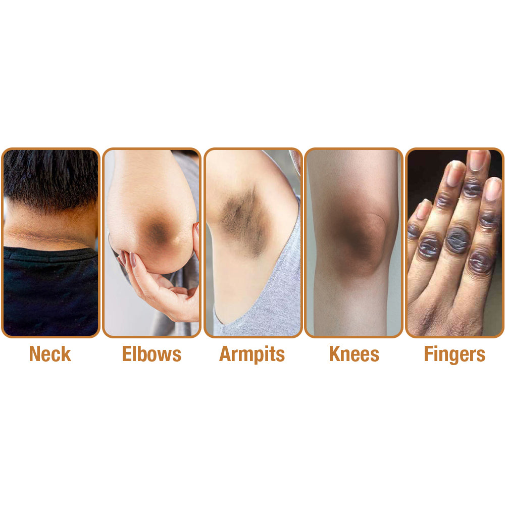 Dobshow™ ShineLuster Bee Venom Clinical Strength Soap for Skin Clarity