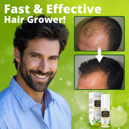 CVREOZ® Nourish & Flourish Hair Growth Spray + 5%Minoxidil