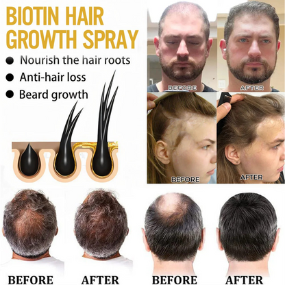 🔥 Grow Your Glow: 60% OFF 🔥 Cvreoz® Biotin Hair Essential Oil!