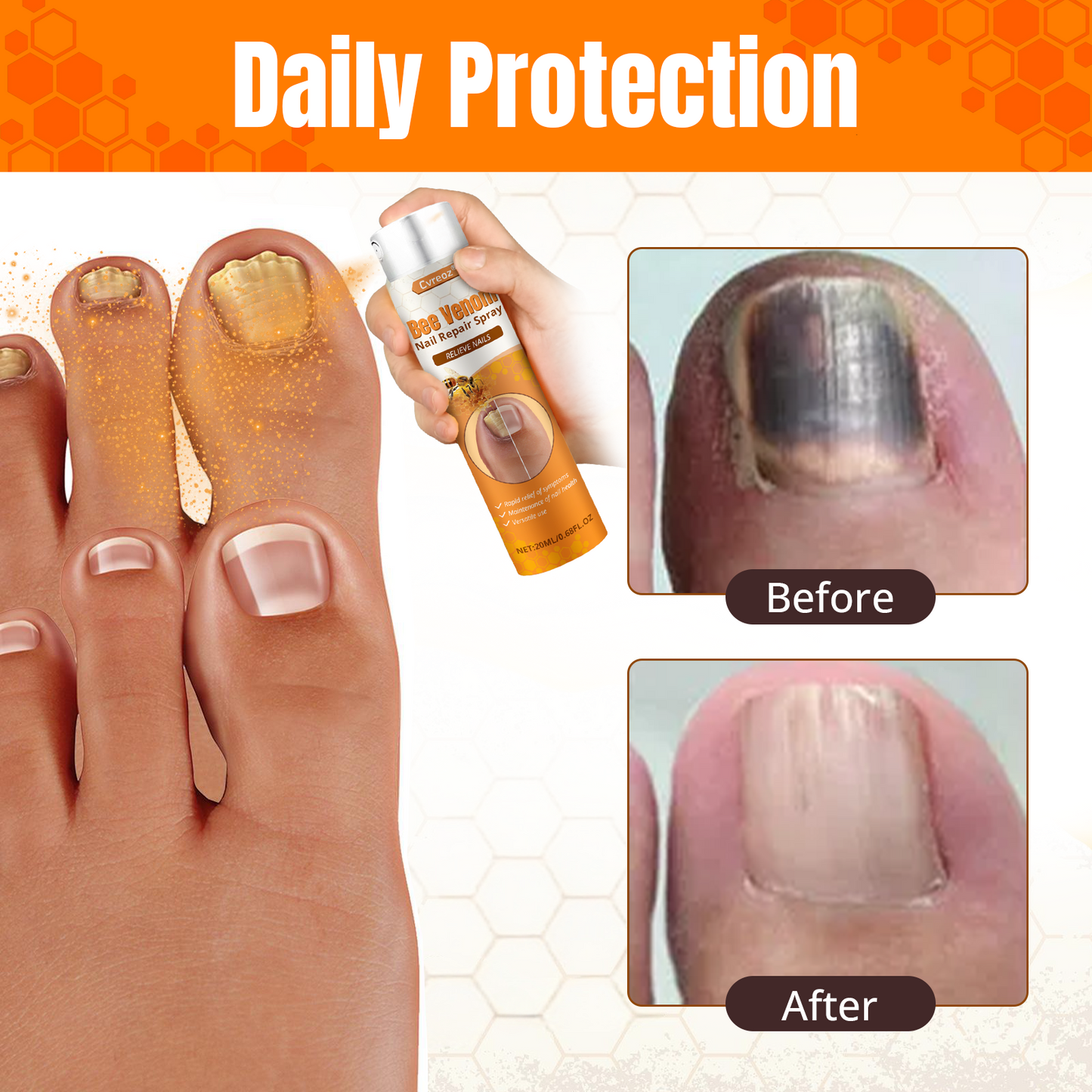 Cvreoz® Bee Venom Nail Repair Spray – Clinically Inspired Relief for Fungal & Damaged Nails🌺