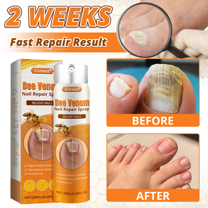 Cvreoz® Bee Venom Nail Repair Spray – Clinically Inspired Relief for Fungal & Damaged Nails🌺
