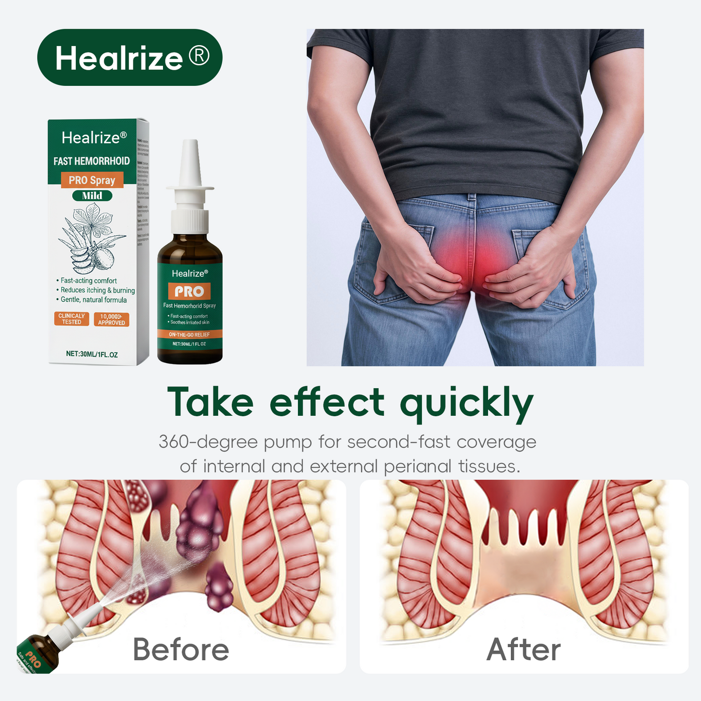 🎁𝘾𝙝𝙧𝙞𝙨𝙩𝙢𝙖𝙨 𝙎𝙖𝙡𝙚 | Healrize® Fast Hemorrhoid PRO Spray