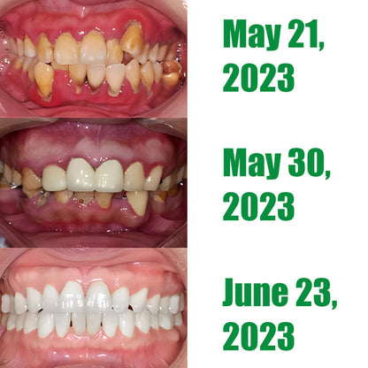 Dobshow™BeeVita Oral Shield: Professional Anti-Inflammatory Treatment for Oral Health with Natural Bee Venom🐝