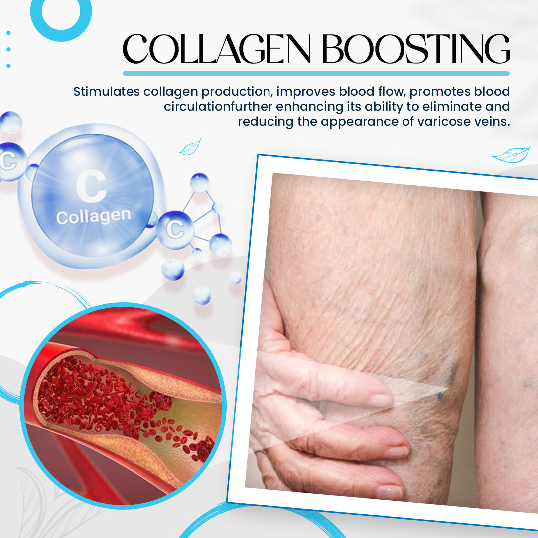 Dobshow™ Varicose Veins Treatment Cream