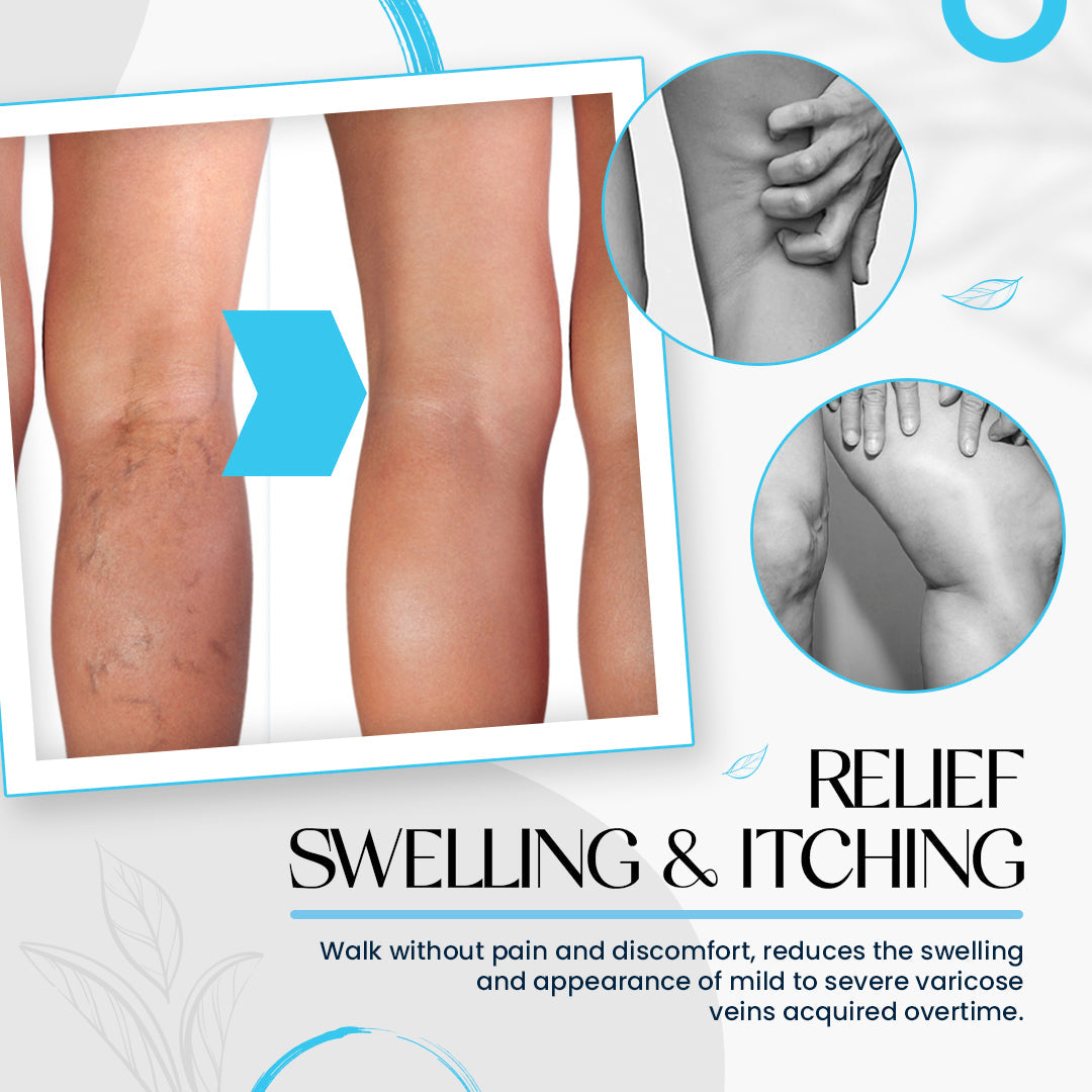 Dobshow™ Varicose Veins Treatment Cream