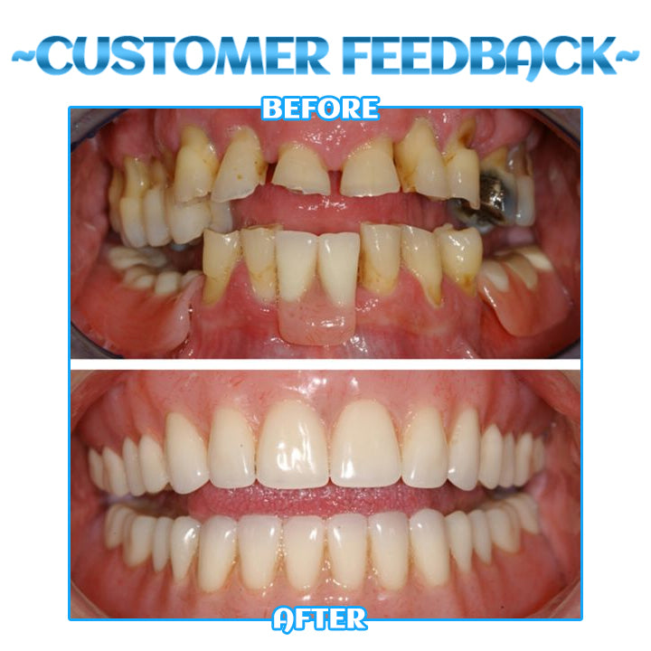 Dobshow™ SmileBright Mousse 🌟✨ Total Oral Care 🦷💧