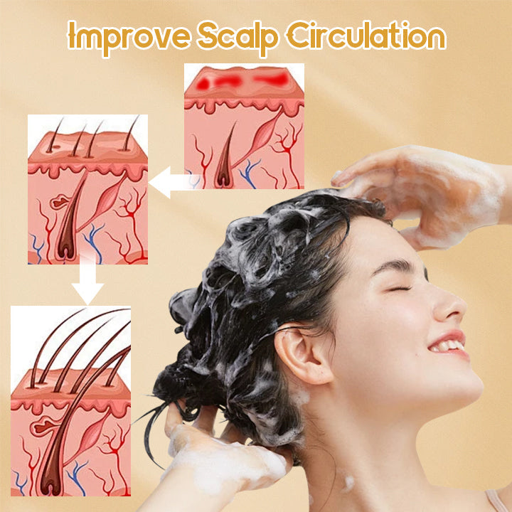 Dobshow™ Anti-Hair Loss Ginger Shampoo Soap