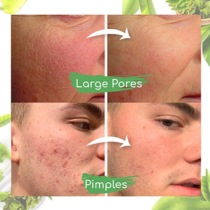Dobshow™ Green Tea Clay Mask Stick For Oil Control, Blackhead Reduction, and Pore Minimization